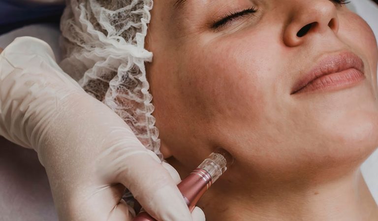 Smart Loyalty & Rewards Personalization